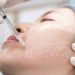 Meso Botox là gì: Giải pháp hoàn hảo để trẻ hóa làn da