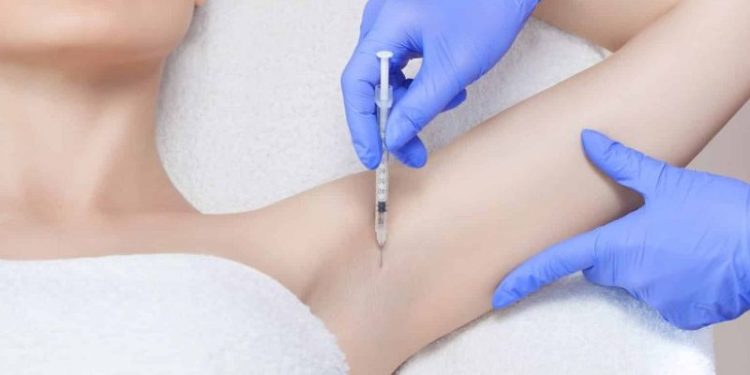 Tiêm botox trị hôi nách giá bao nhiêu để tạm biệt mùi hôi kín?