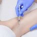 Tiêm botox trị hôi nách giá bao nhiêu để tạm biệt mùi hôi kín?