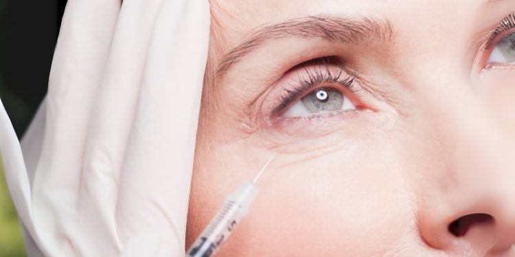 Tiêm Botox xóa nhăn: Bí quyết trẻ hóa thần tốc